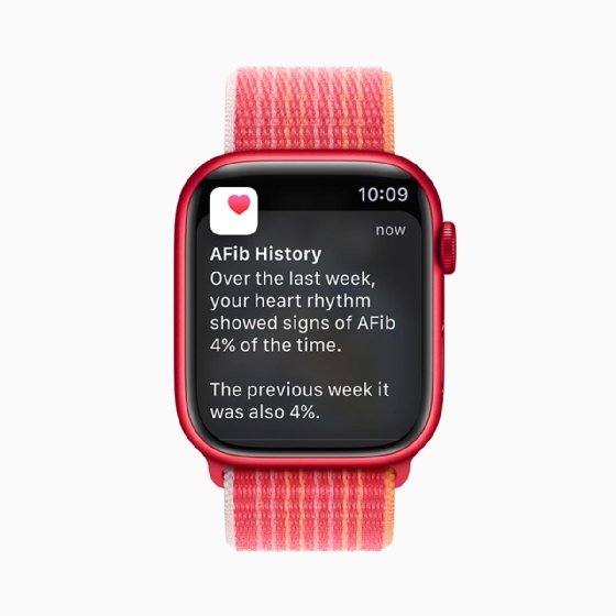 Photo of watchOS AFib