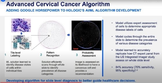 Screenshot of Hologic and Google's presentation of the use of AI in diagnosing Cervical Cancer