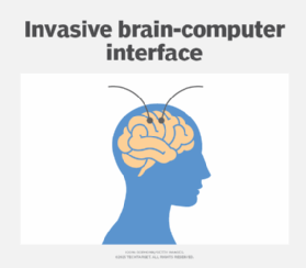 An example of an invasive brain-computer interface.